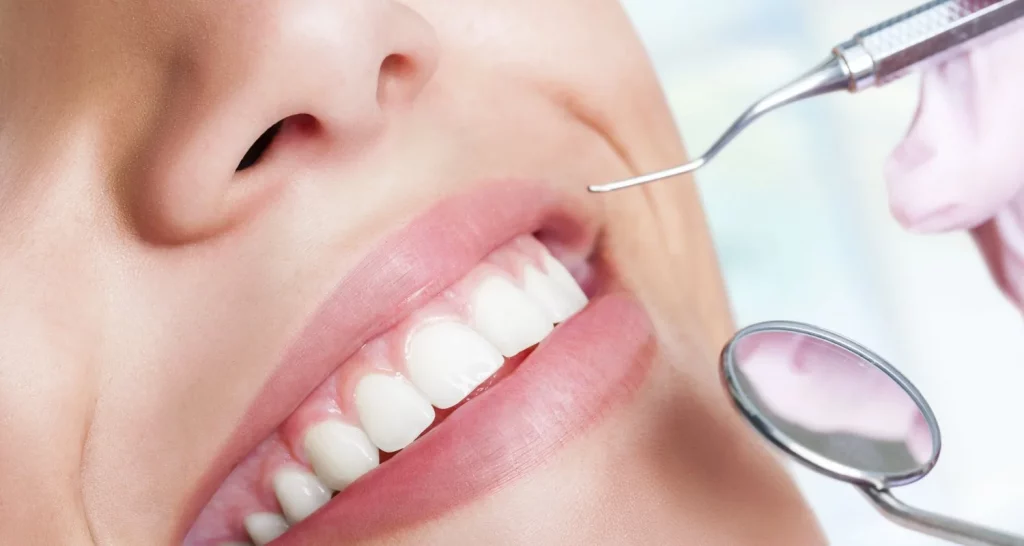 Manejo De La Halitosis_ Procedimientos Y Terapias Dentales