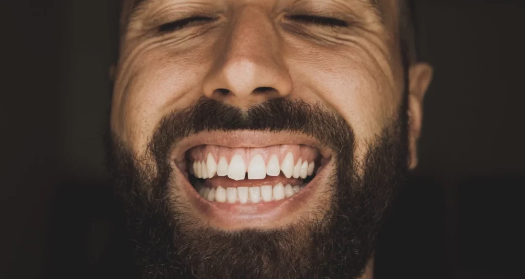 ¿Siempre es necesario corregir los espacios entre los dientes (Diastema)