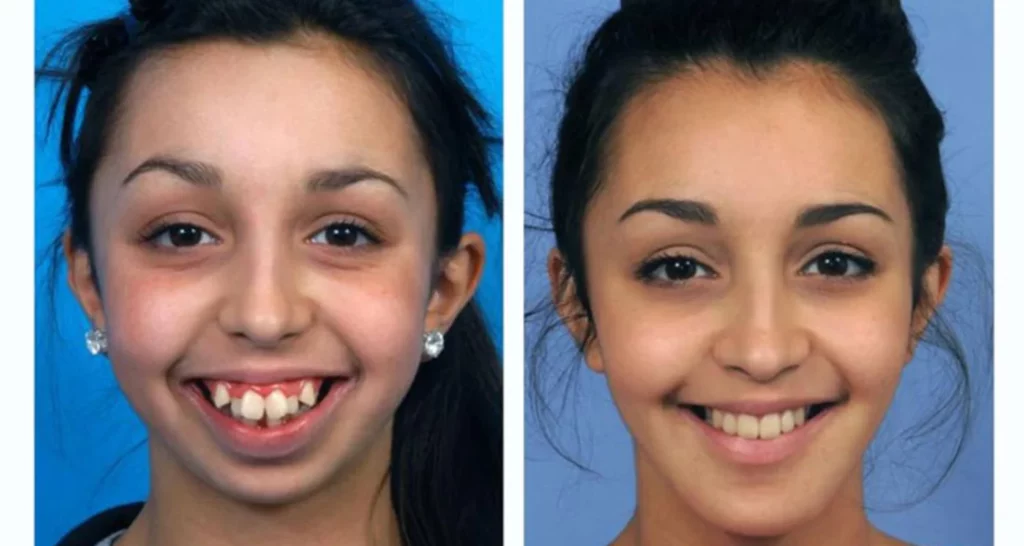 Transformative results of oral and maxillofacial surgery