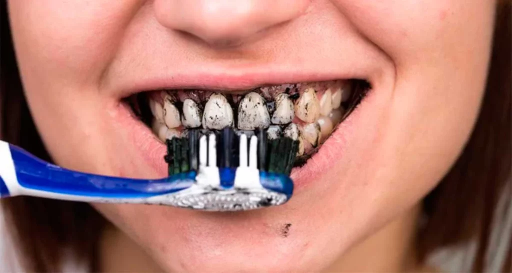 What do the studies show_ Is charcoal toothpaste safe for oral health