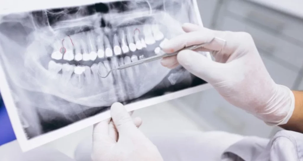 What to expect at a dental prophylaxis appointment
