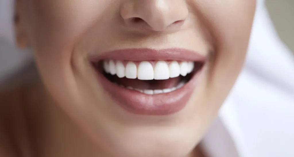 Descubre los riesgos de la gingivectomía y cómo evitarlos