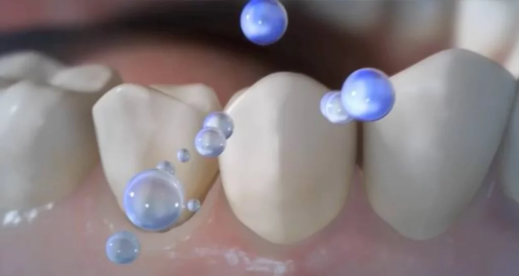 Beneficios de la hidroxiapatita para la salud dental 10 ¿Qué es la hidroxiapatita para la salud dental