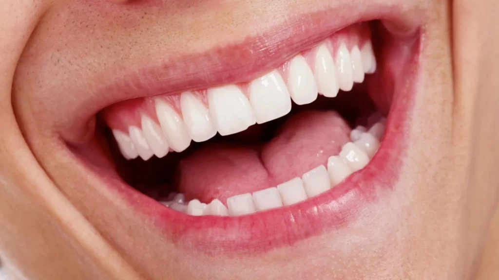 ¿Cuáles son los beneficios de la mirra en la salud bucal? 14 Salud de las encías