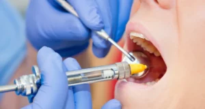 Common Risks of Local Anesthesia  in Dentistry Explained