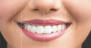 Is teeth reshaping good for you? The experts said this!