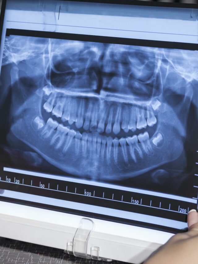 panoramic-dental-x-ray