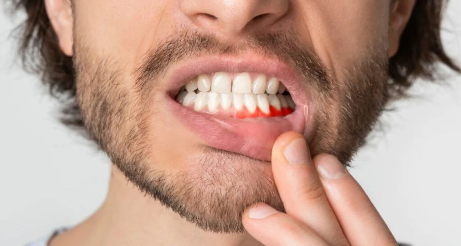 2 - Causas comunes de sensibilidad dental o molestias al morder