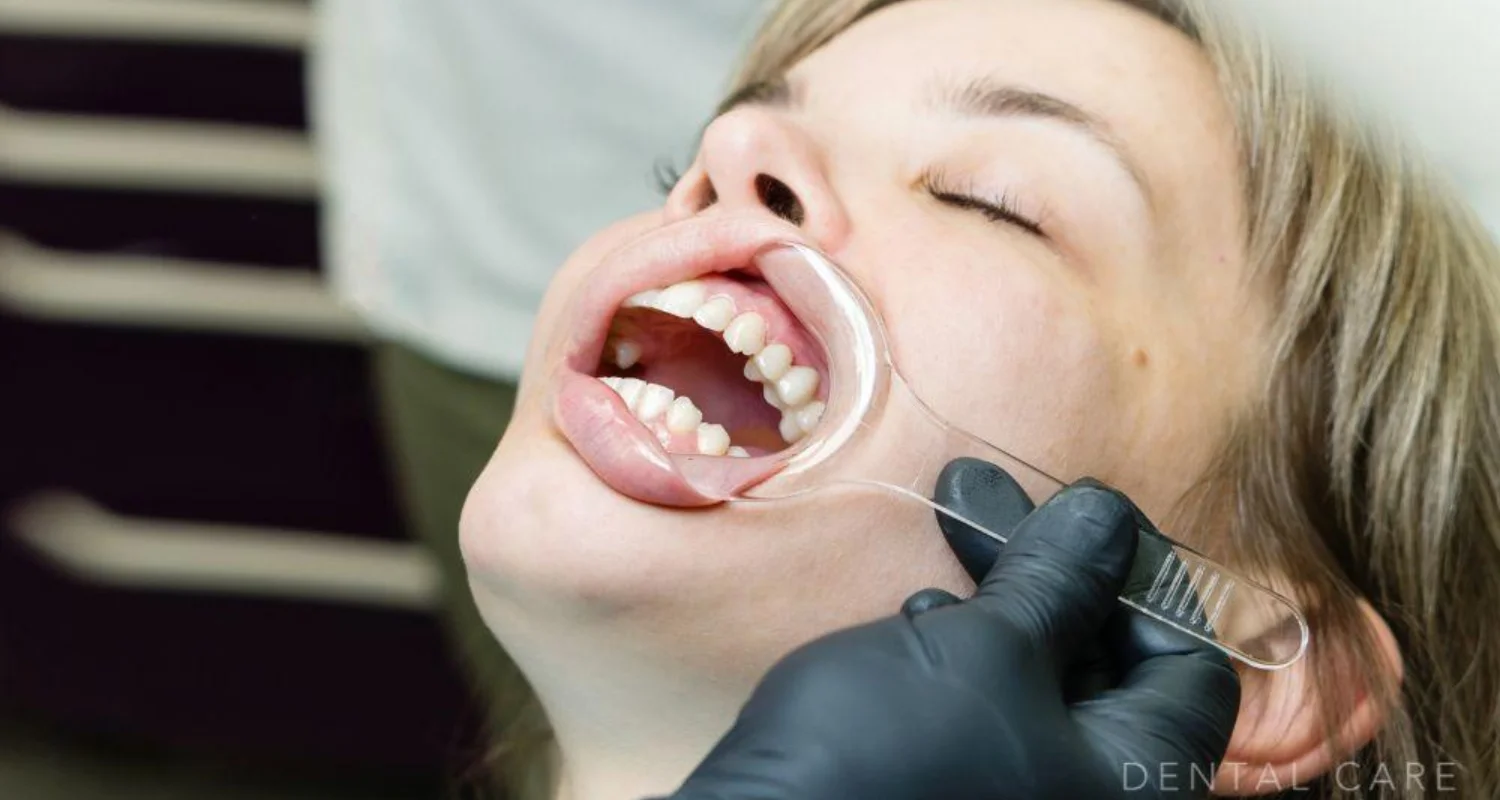 3 - ¿Es normal sentir dolor después del empaste dental