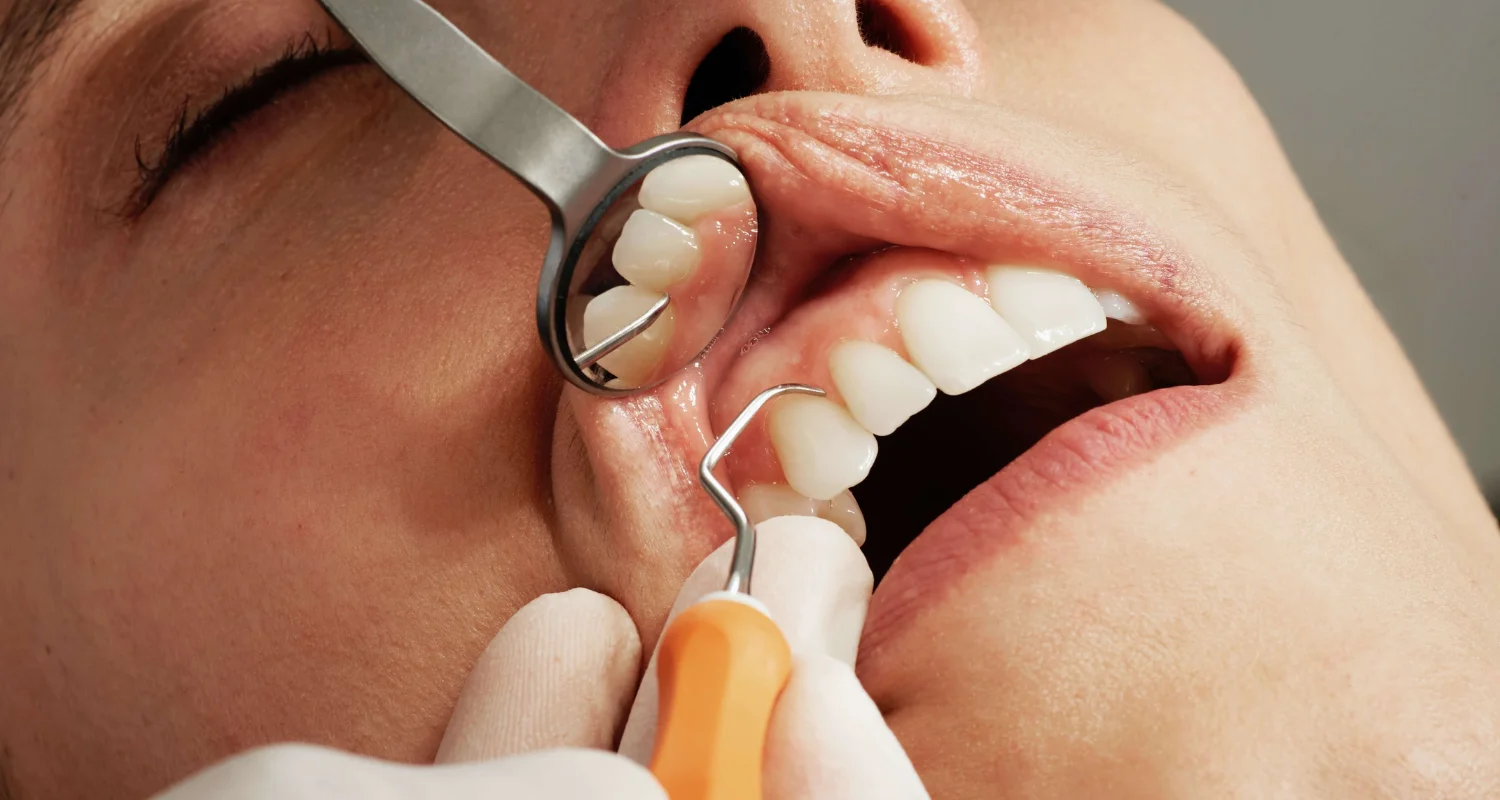 5 - What to do if Tooth Pain After Filling Doesn’t go Away