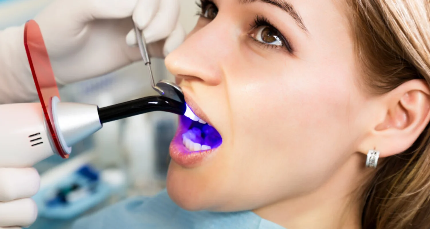 8 - ¿Cuándo se debe cambiar un empaste dental_ - dolor después del empaste dental