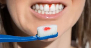 gum disease treatment at home