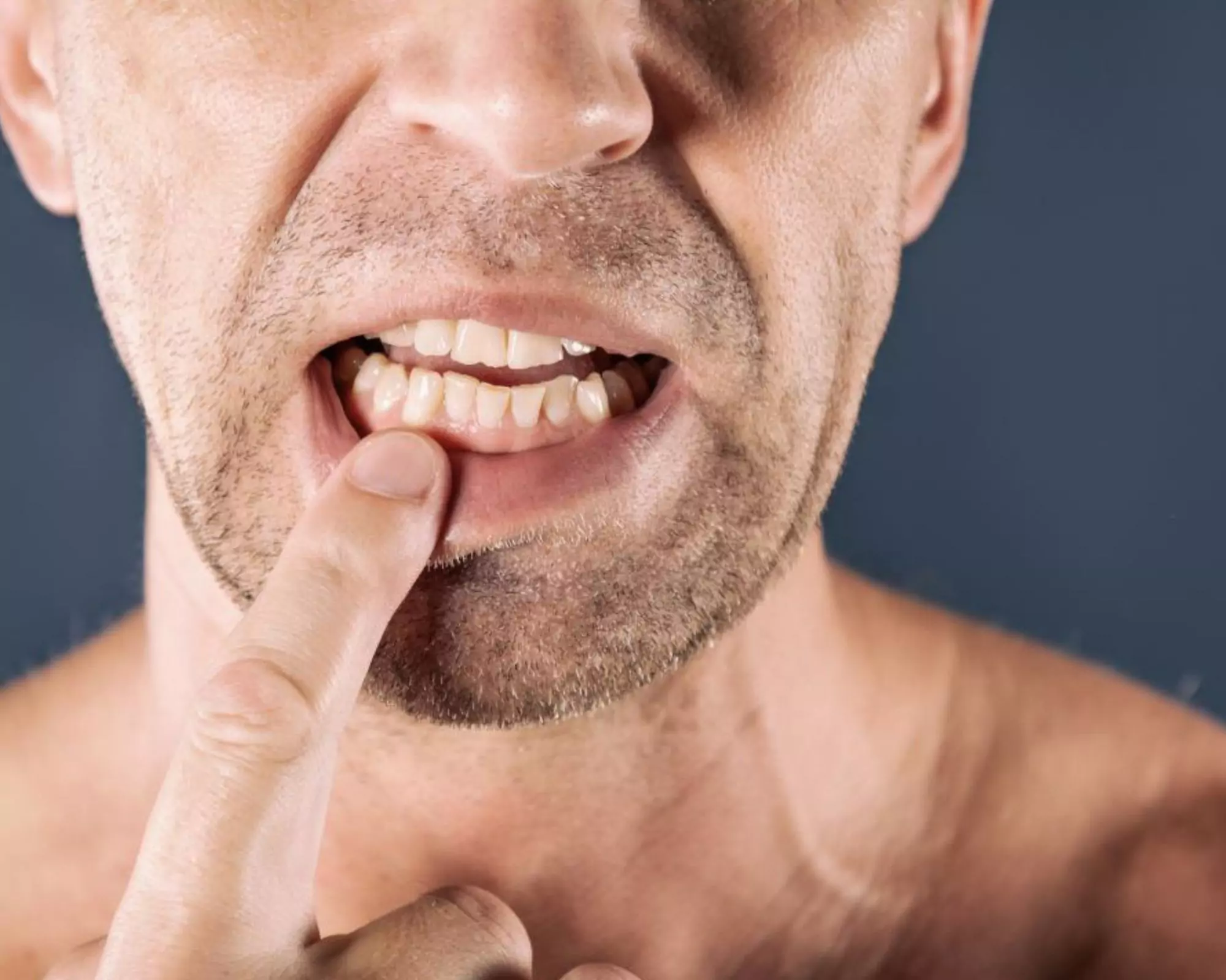 5 Powerful ways to treat a bruised tooth quickly