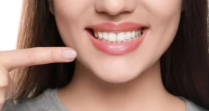 1 - Peg Teeth_ Symptoms, Causes, and Treatment Tips