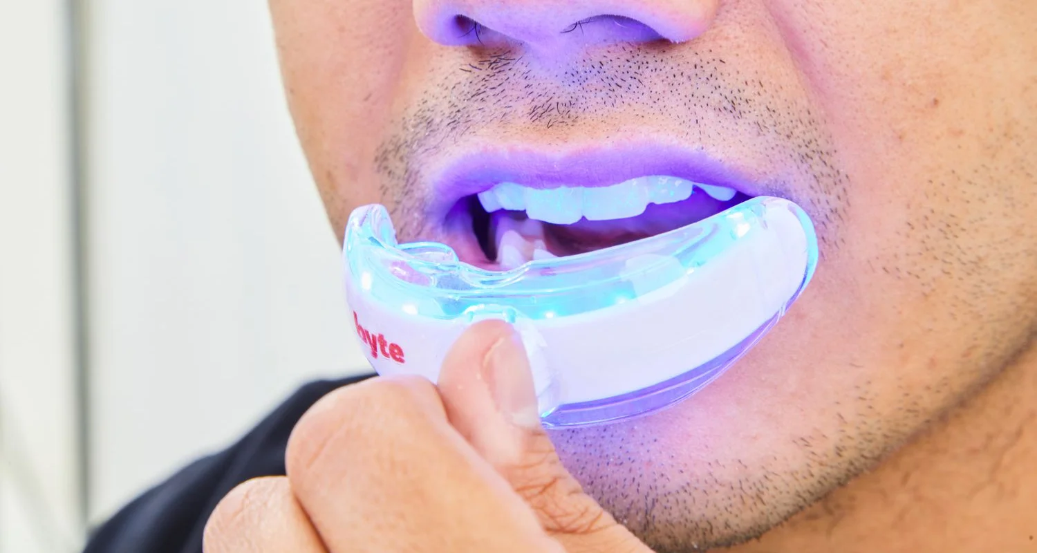 2 - How does LED teeth whitening work