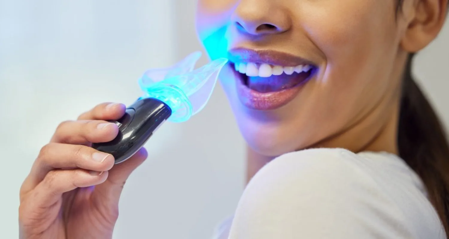 4 - Luz LED blanqueadora de dientes vs otros tratamientos de blanqueamiento dental en el hogar