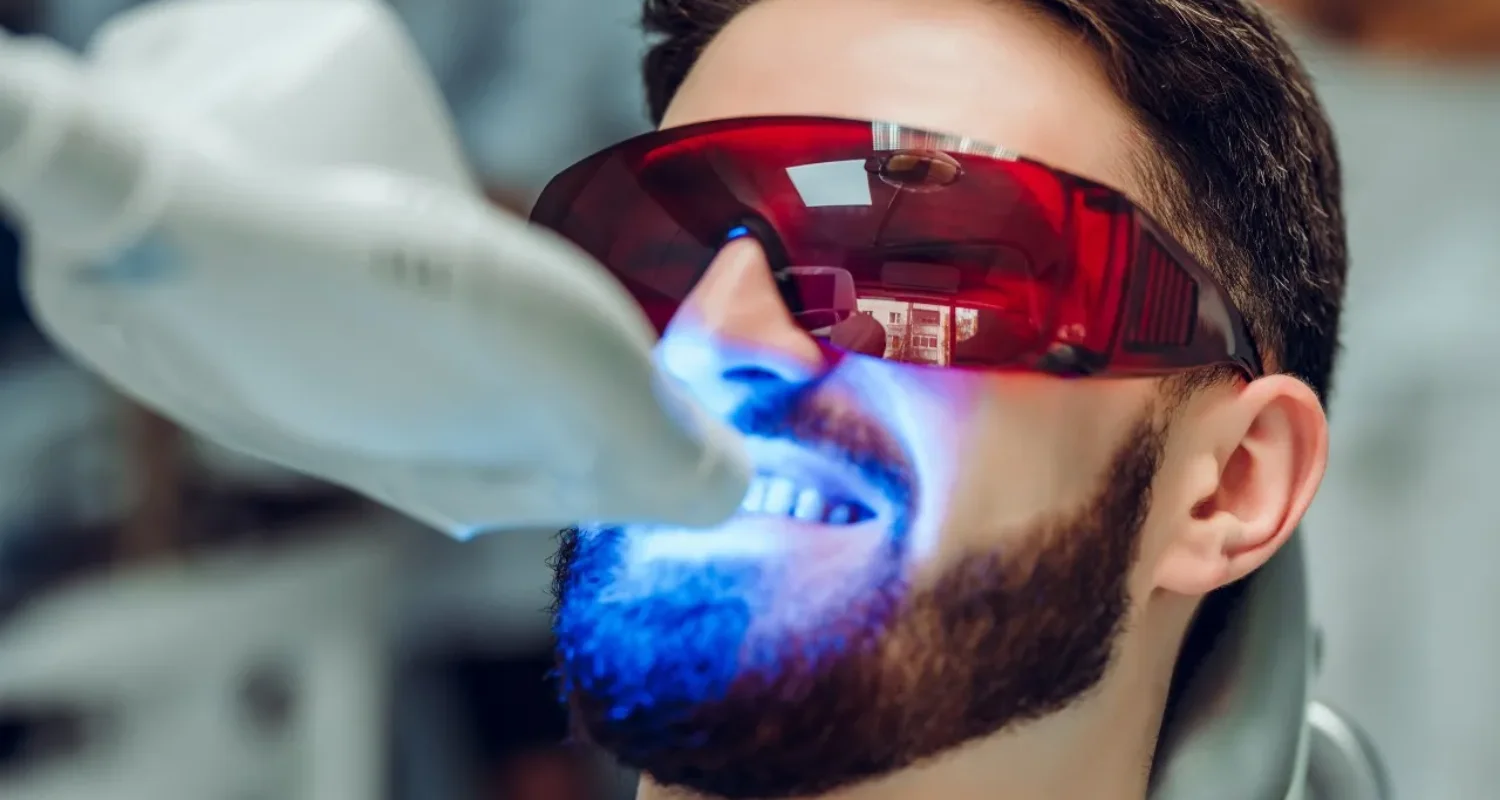 5 - LED teeth whitening vs. laser whitening