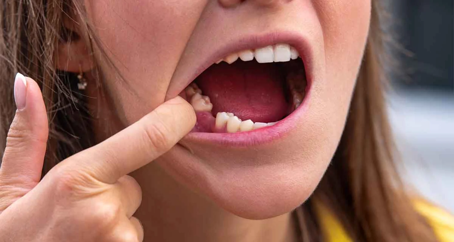 6 - Signs that you need to see a doctor - natural antibiotics for gum infection