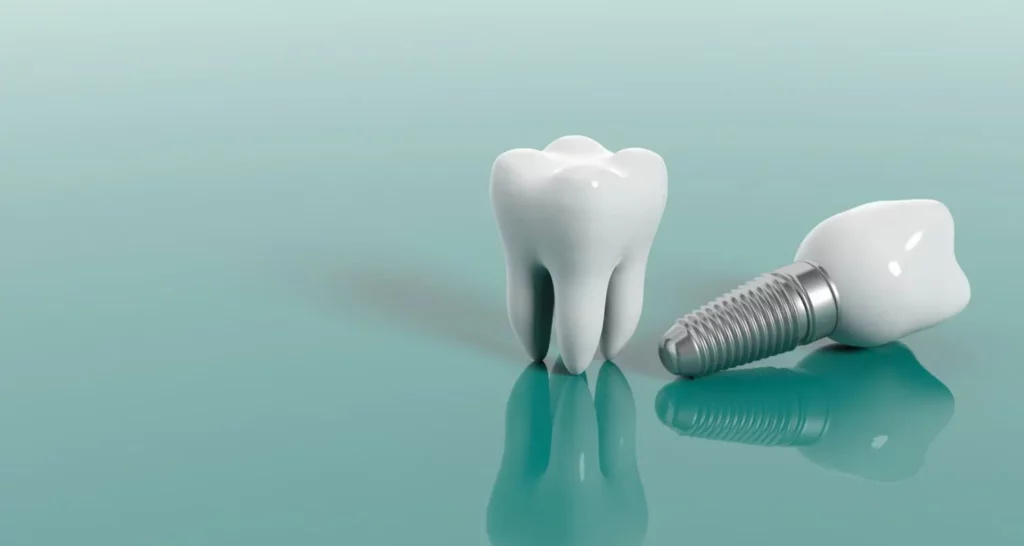 1 - Cómo cuidar un implante dental paso a paso