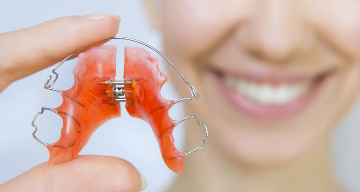 1 - Palatal Expander for Adults_ Pros, Cons, and Best Options