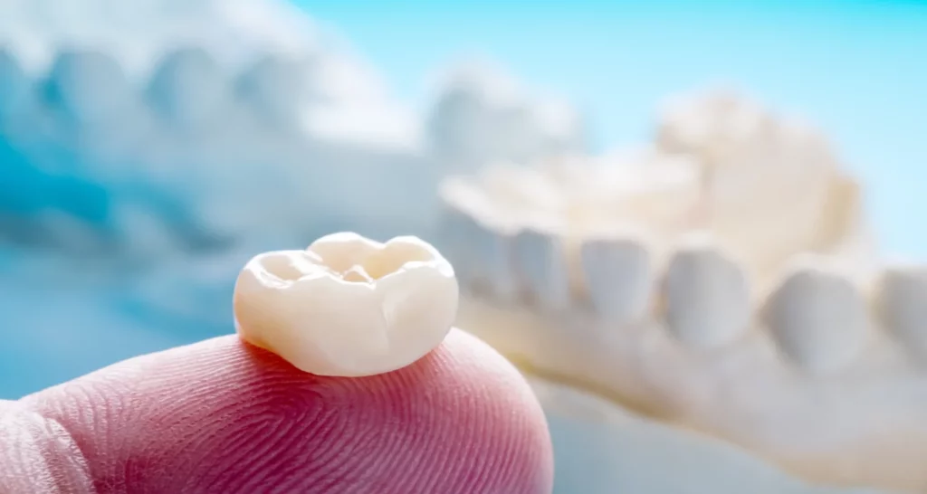 1 - Teeth Glue Guide_ Types, Uses, and Risks Explained