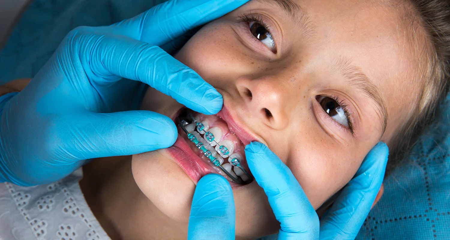 4 - Is your child a candidate for interceptive orthodontic treatment