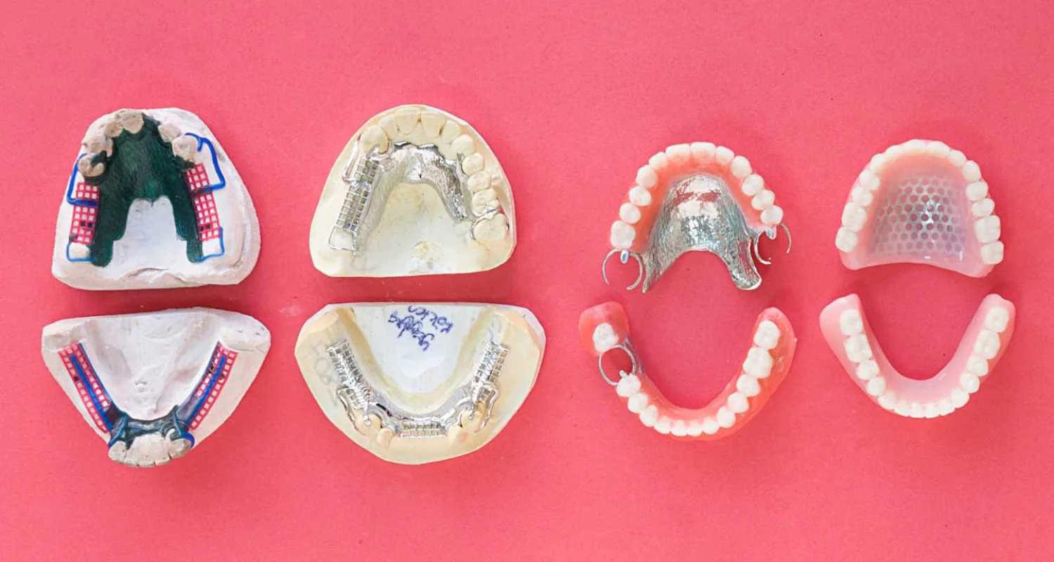 4 - Who might need a palatal expander for adults