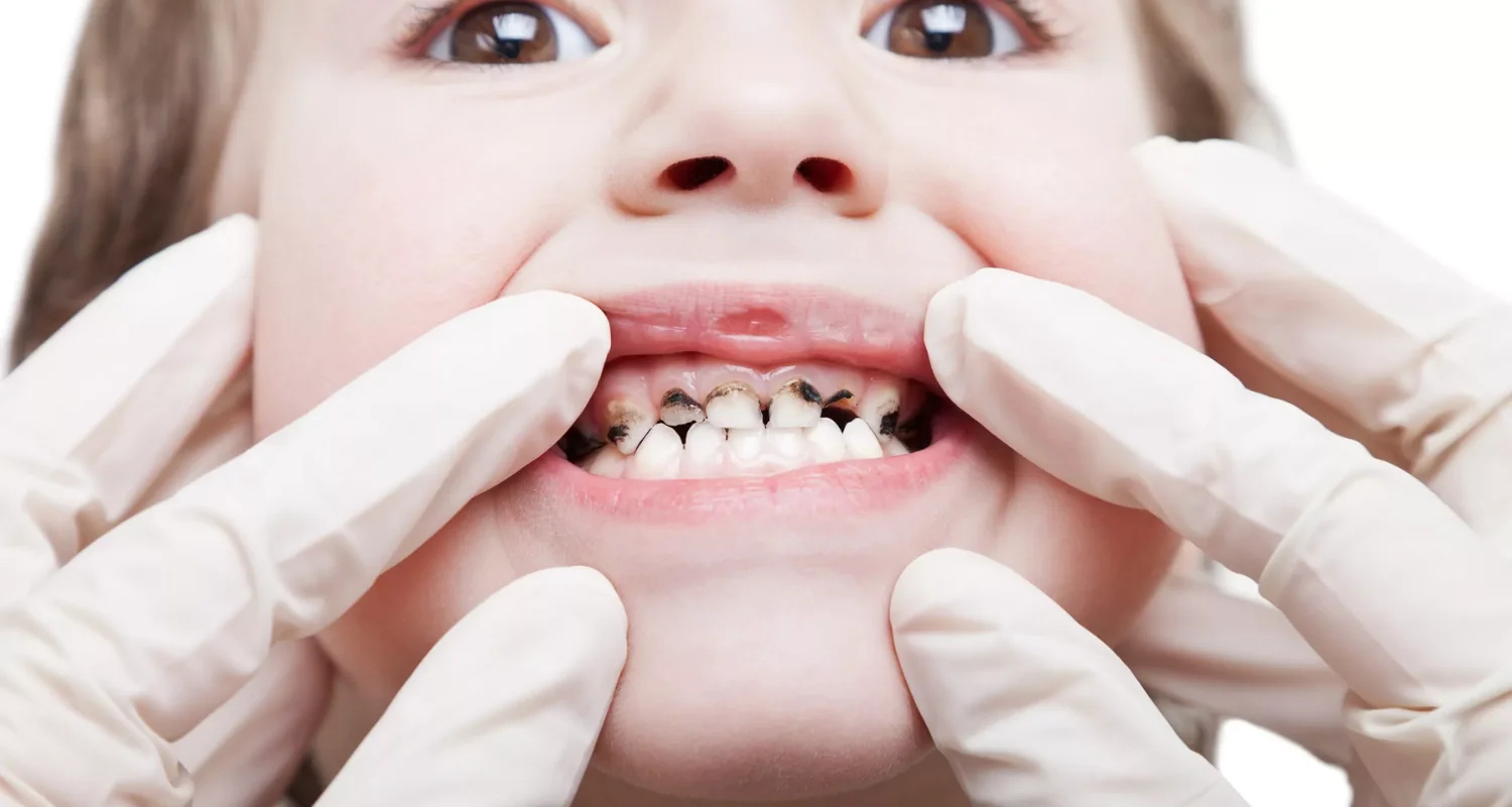 5 - When NOT to use interceptive orthodontic treatment