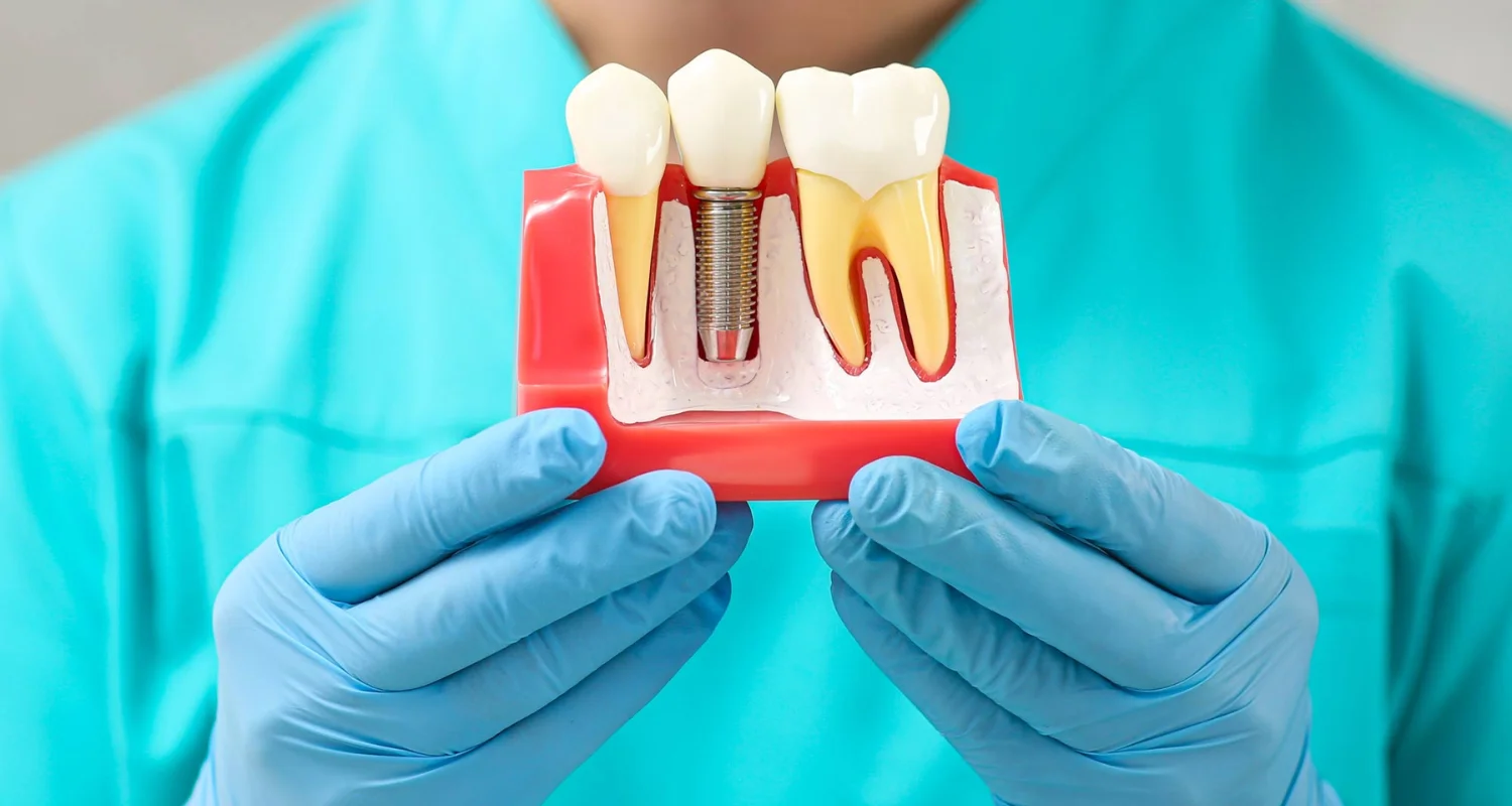 5 - When to see a dentist after dental implants - aftercare for dental implants