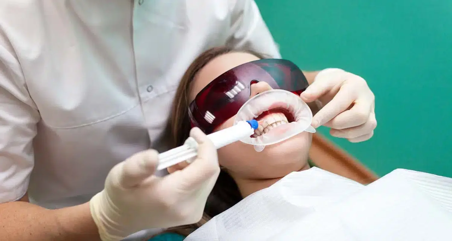 7 - Consulta a tu dentista si notas sensibilidad - manchas de tabaco en los dientes