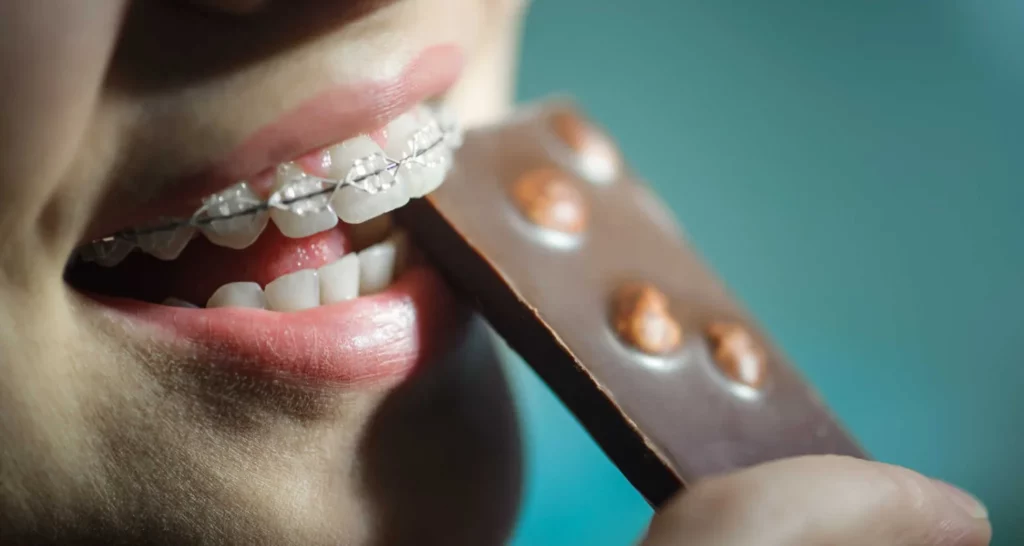 1 - ¿El chocolate daña los dientes_ Tips para protegerlos