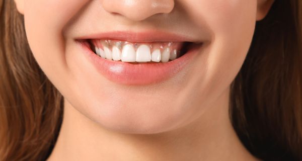 Purple Gums: What They Mean and How to Treat Them