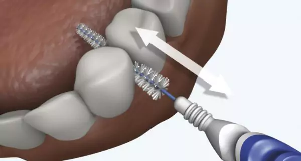 How to use an interdental brush (step-by-step guide)