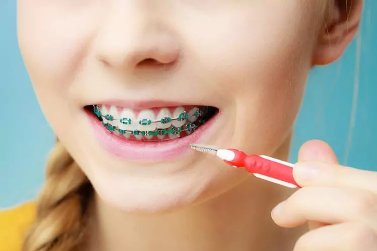 how to use an interdental brush