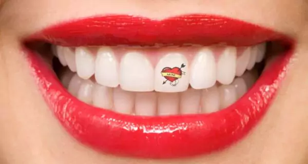 ¿What is a tooth tattoo?