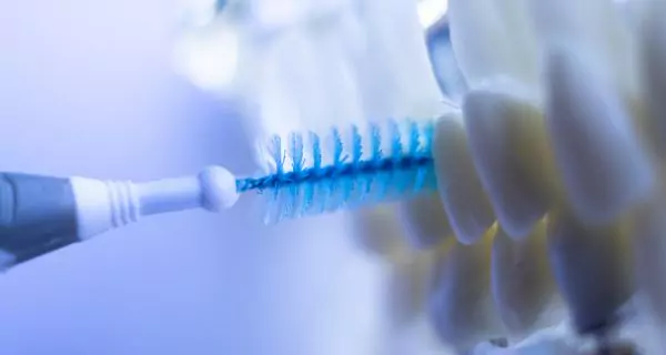 What is an interdental brush?