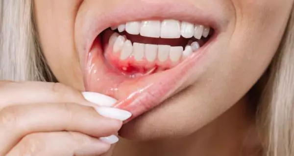 Who should avoid a tooth tattoo?