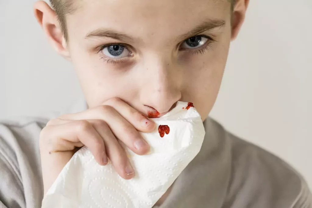 Essential Care for a Sports Dental Injury at Home
