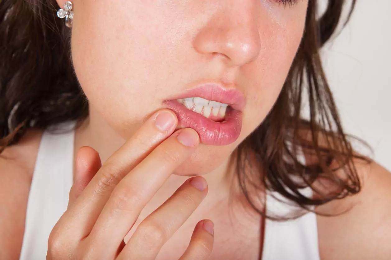 Grano dentro del labio: posibles causas y cómo eliminarlo
