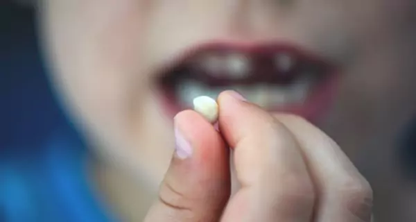 When to see a dentist?