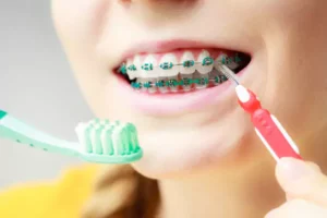 The Right Interdental Brush Can Transform Your Oral Health
