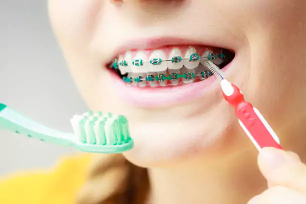 The Right Interdental Brush Can Transform Your Oral Health