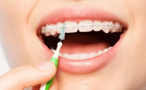 mejor cepillo interdental