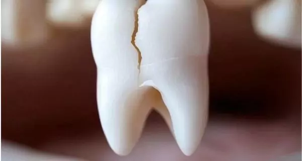 no pain means no dental problems