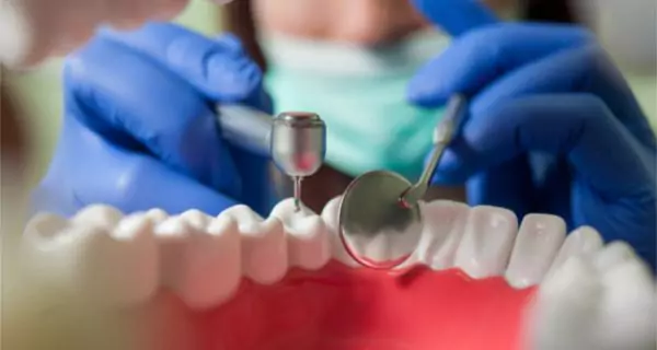 ¿Qué es una endodoncia y porque es necesaria?
