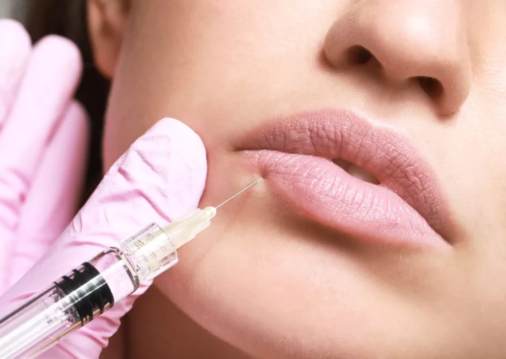 ¿Es seguro aplicarse botox alrededor de la boca?