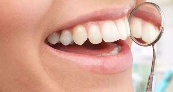 ¿Cuáles son los beneficios de usar un kit de limpieza dental?