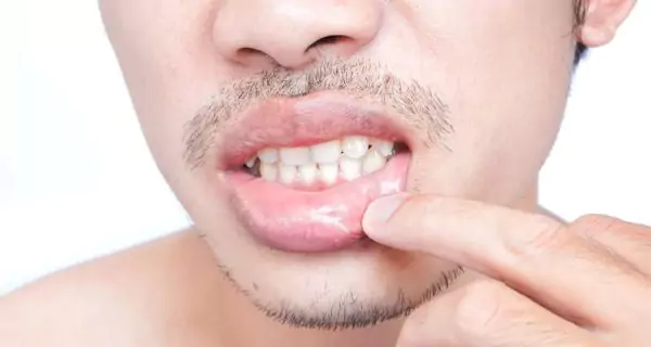 How is lip cancer related to oral health?