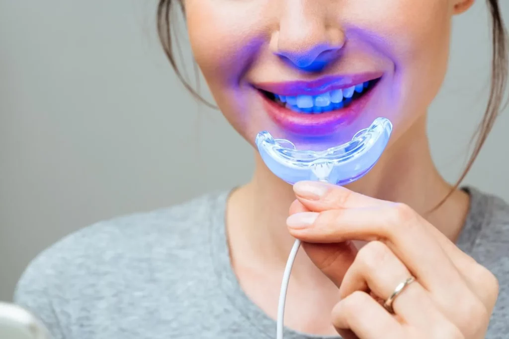How to Choose the Ideal Teeth Whitening Kit?