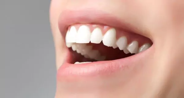 What are the benefits of using a teeth cleaning kit?